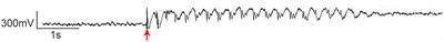 Understanding Epileptiform After-Discharges as Rhythmic Oscillatory Transients